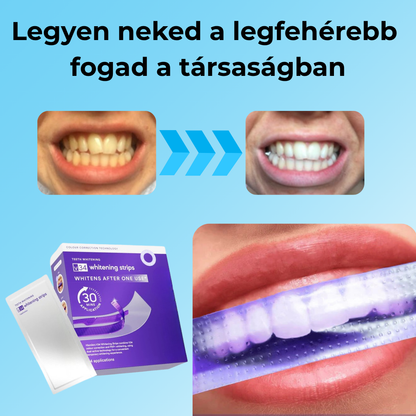 PureDent Fogfehérító tapasz